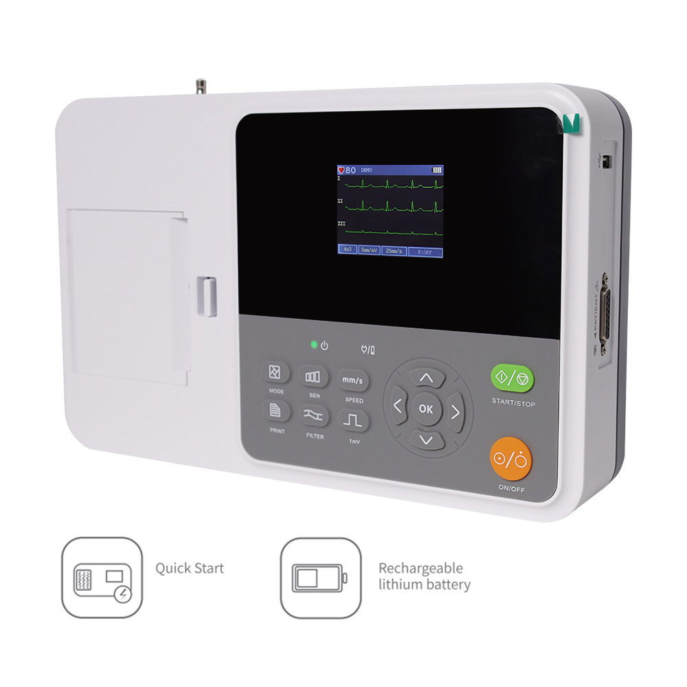 CONTEC E3 Appareil ECG numériq - Ekg Ecg Machine Portable avis et prix